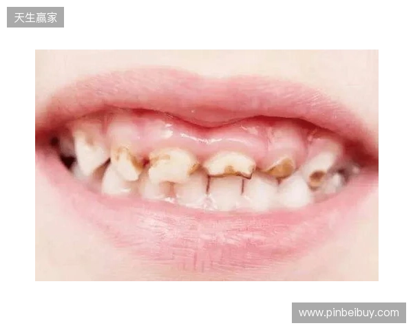 韦林顿确诊上唇部贯通伤;11、21牙半脱位;上颌前牙区牙槽骨骨折